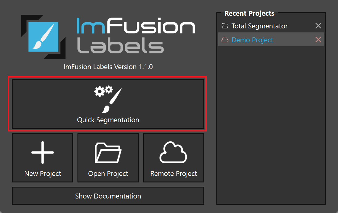 _images/quick-segmentation-button.png