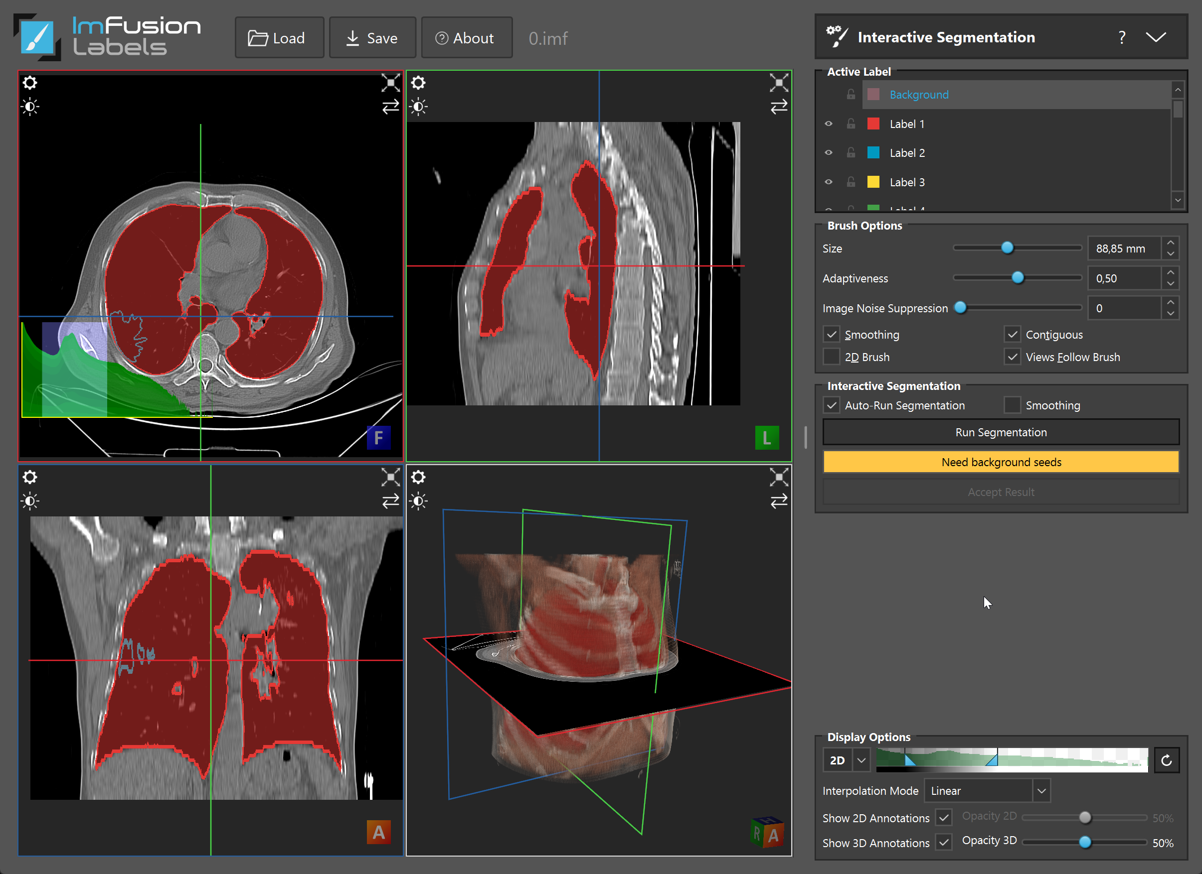 _images/quick-segmentation-workflow.png