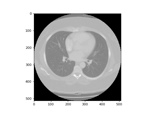 ../_images/ct_image_matplotlib.png