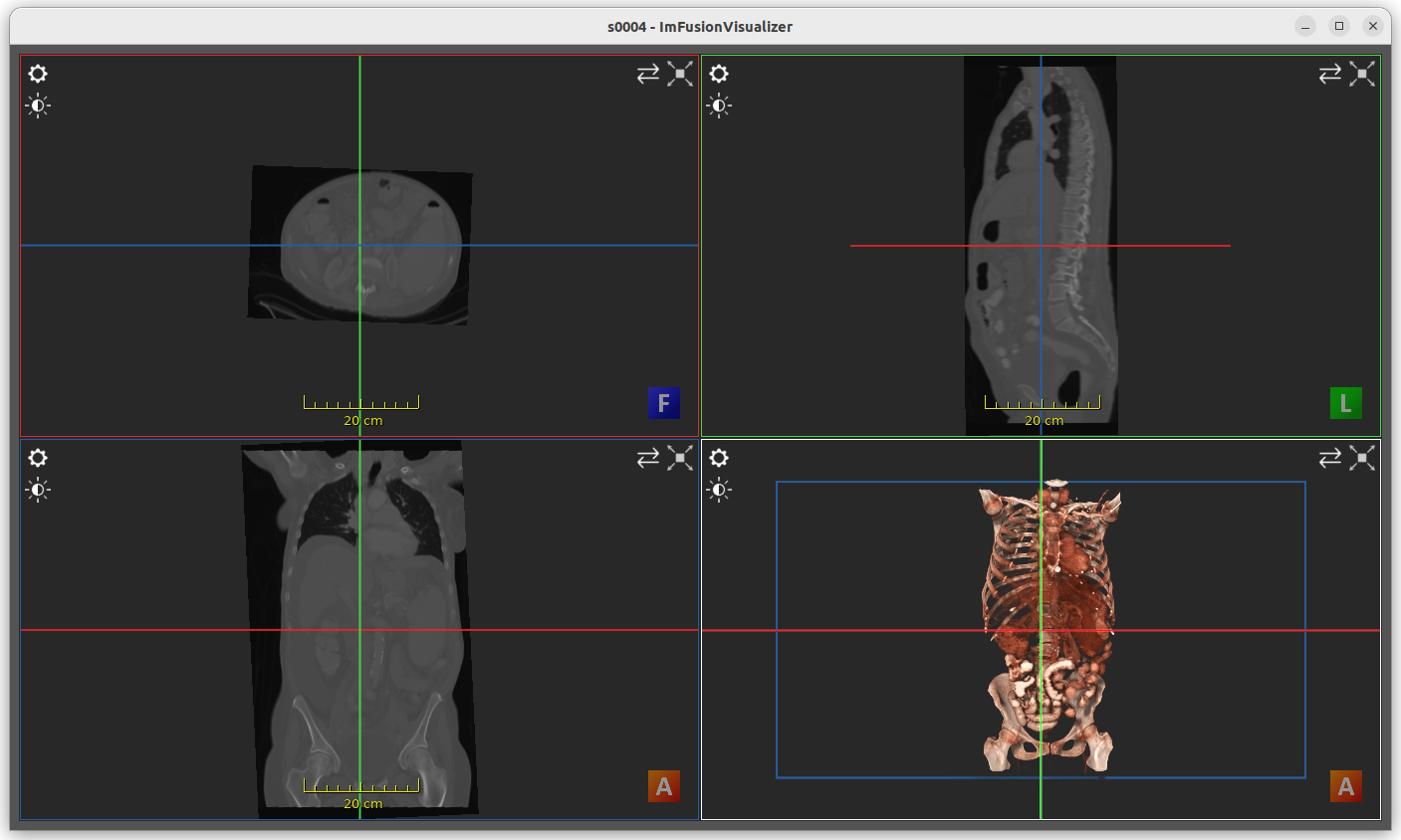 ../_images/visualizer_ts_ct_s0004.png