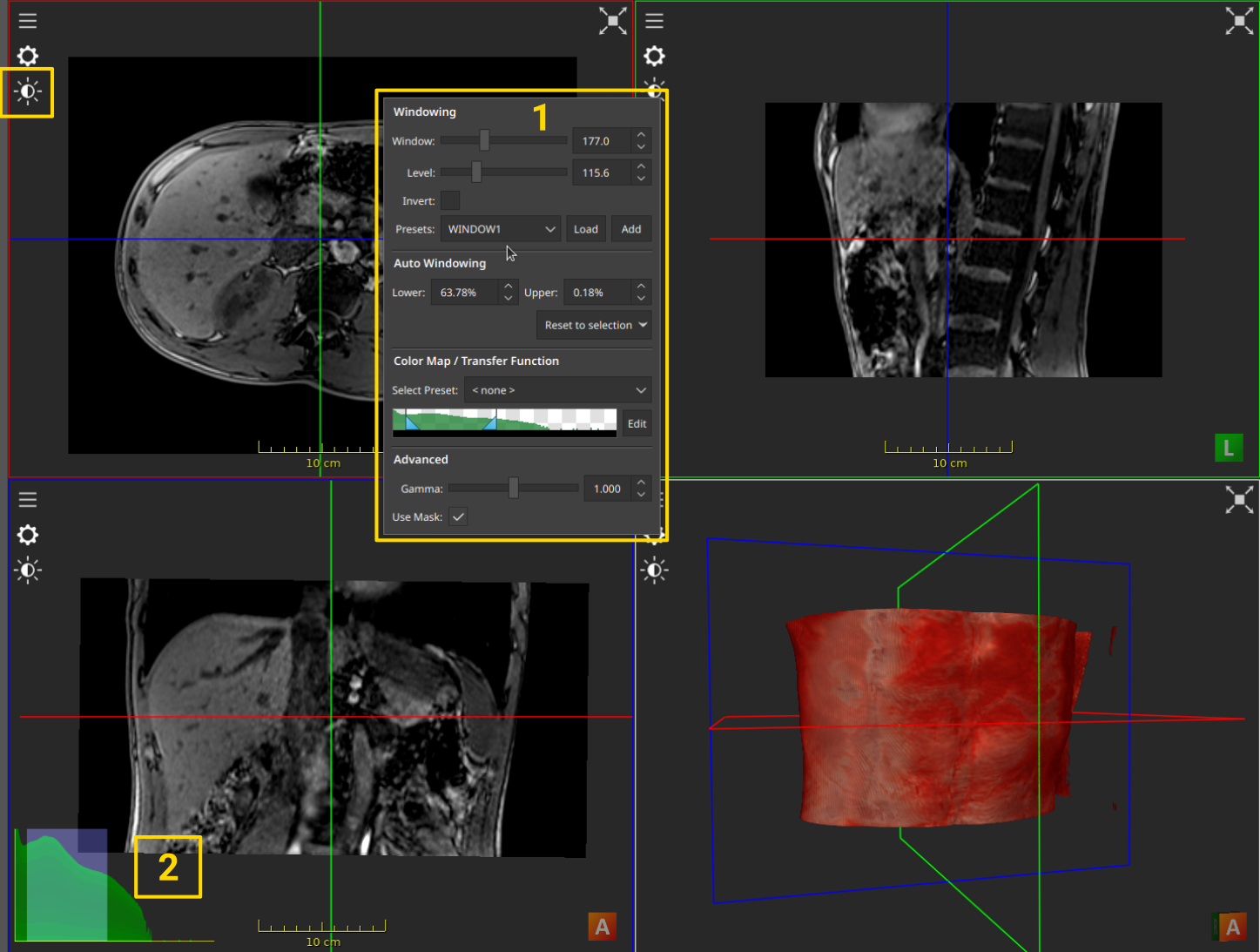 ../_images/visualizer_windowing_menu.png