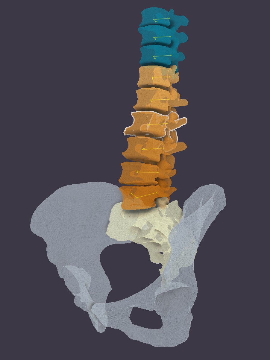 ../_images/SpineShot.png