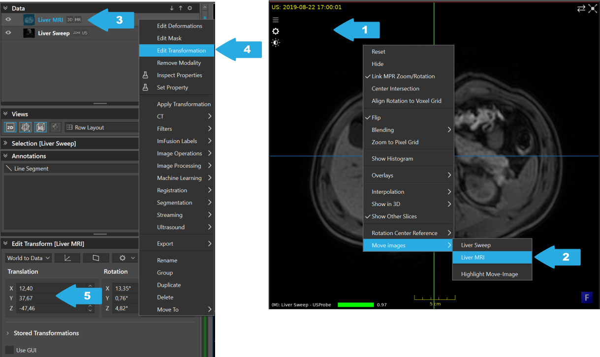 ../../_images/US.UltrasoundRegistrationTutorial.execution01.png