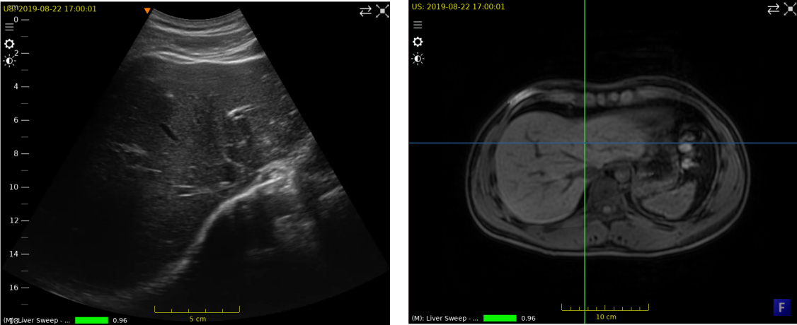 ../../_images/US.UltrasoundRegistrationTutorial.exploration01.png