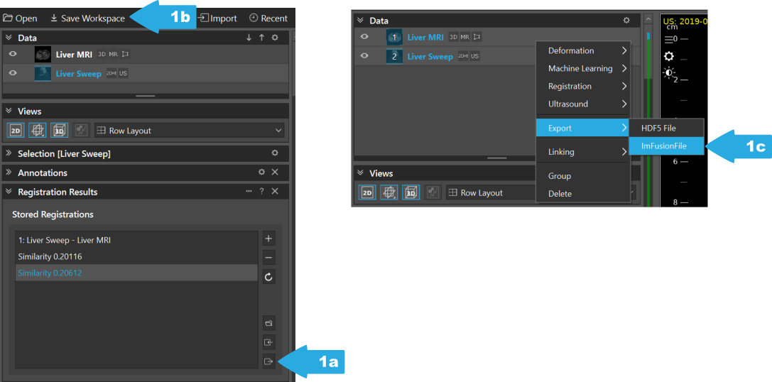 ../../_images/US.UltrasoundRegistrationTutorial.saving00.png