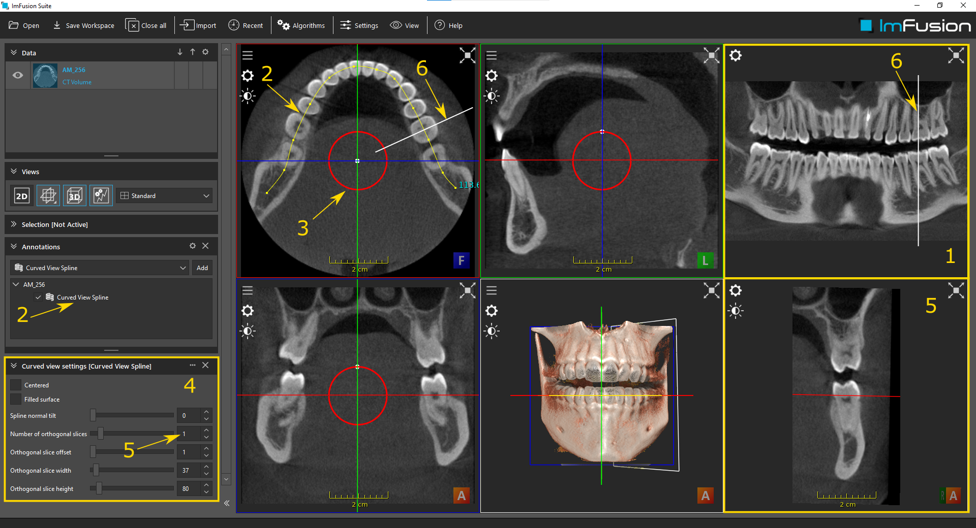 ../_images/annotations-curved-view.png