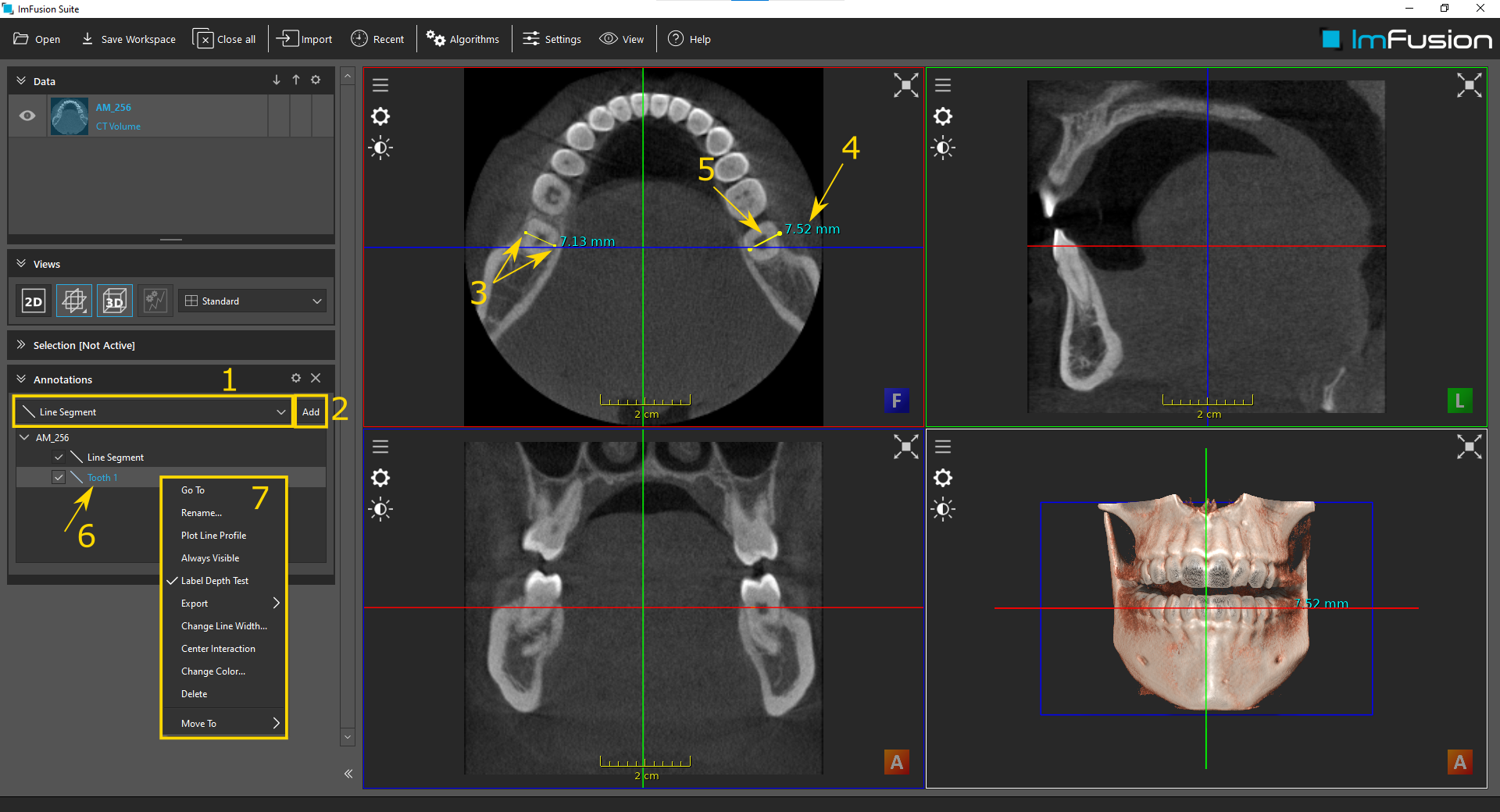 ../_images/annotations-generic.png